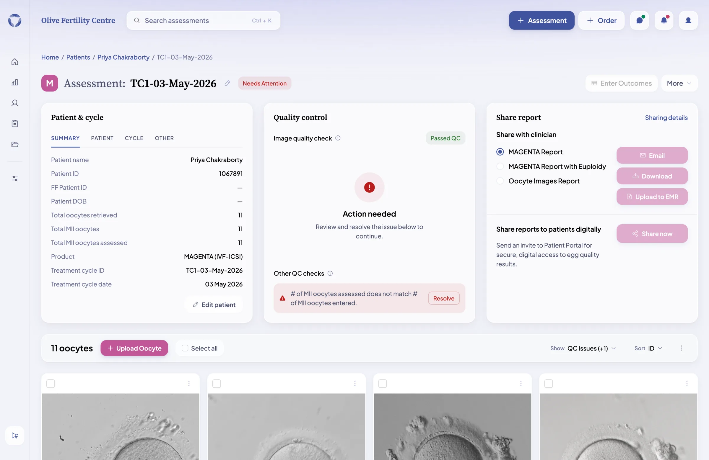 The redesigned MAGENTA assessment detail view — preserved three-panel layout with modernized density and per-oocyte quality control