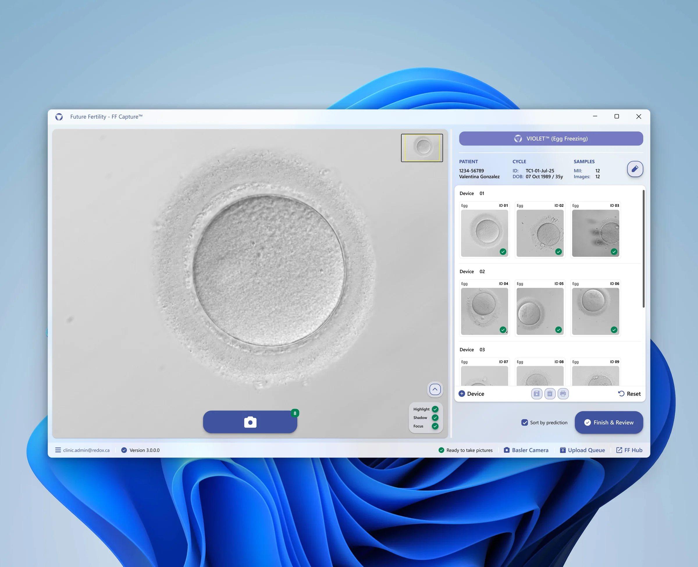 Image Capture — case study preview