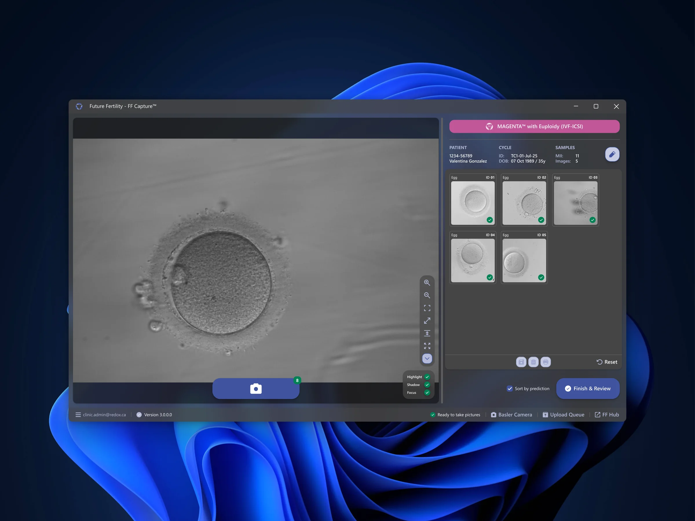 FF Capture — MAGENTA IVF theme, dark mode