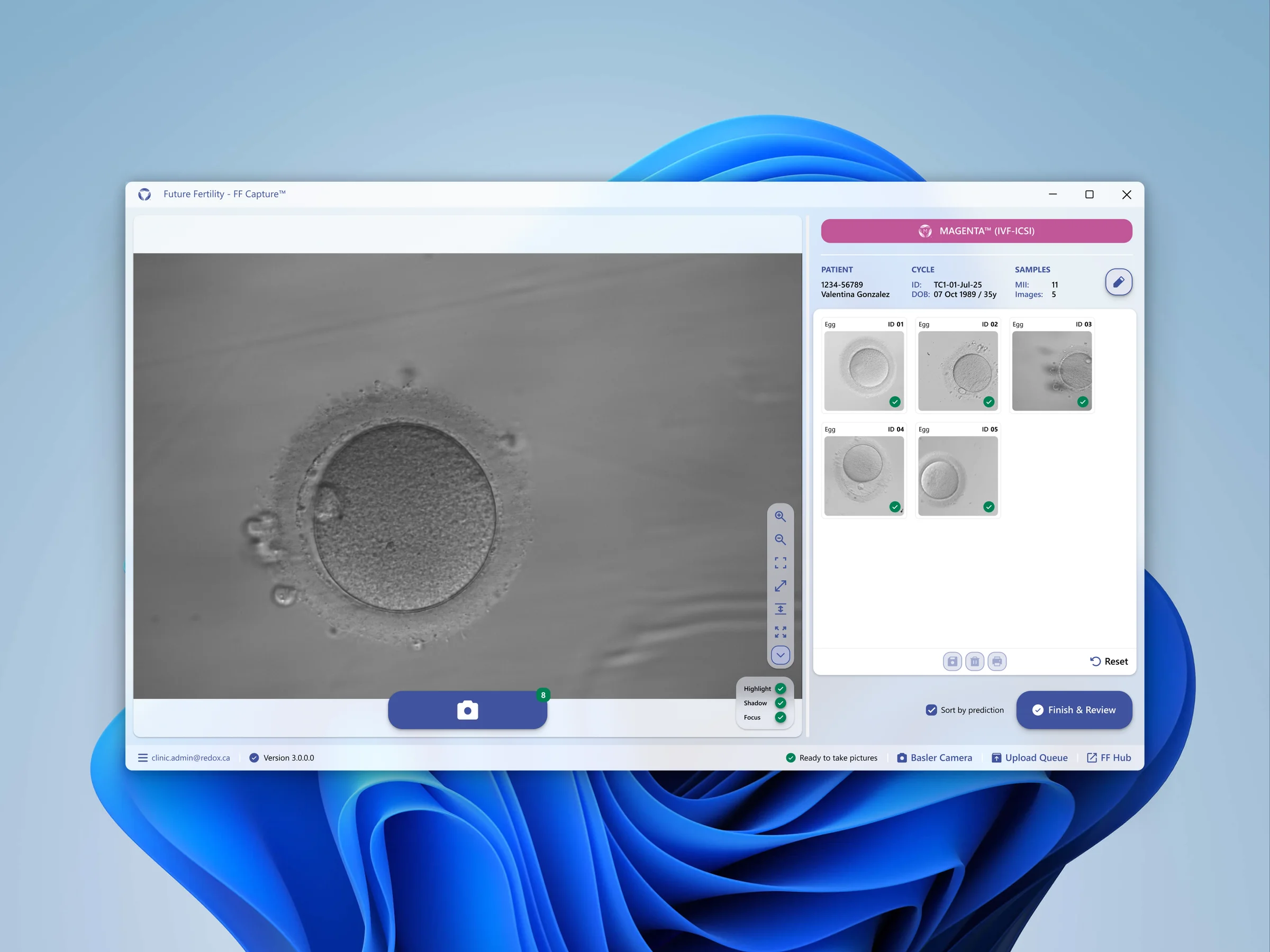 The redesigned capture workspace, MAGENTA IVF theme — image fills the canvas with a calm review rail and per-image QC