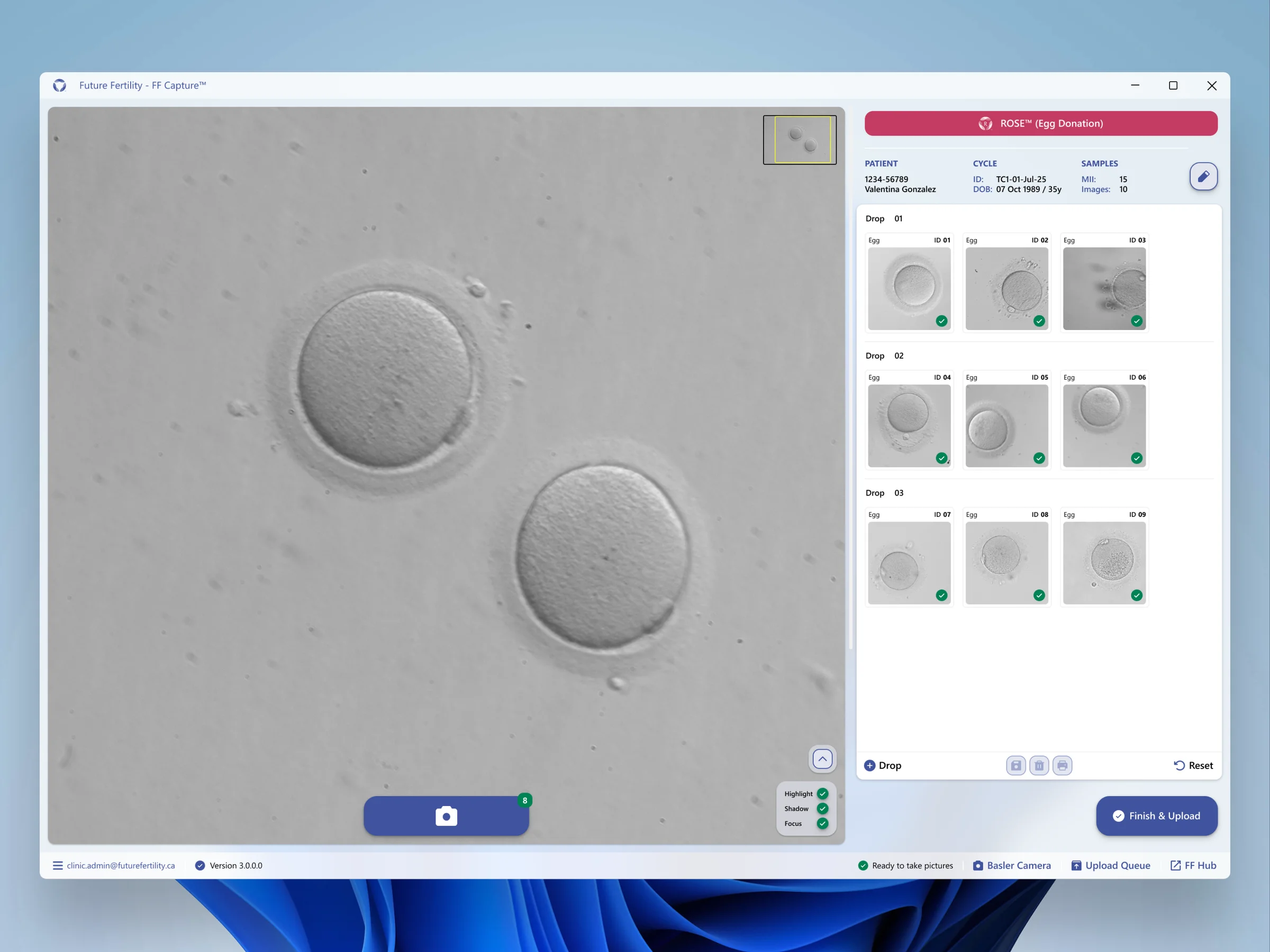 Capture workspace in the ROSE donor-oocyte theme