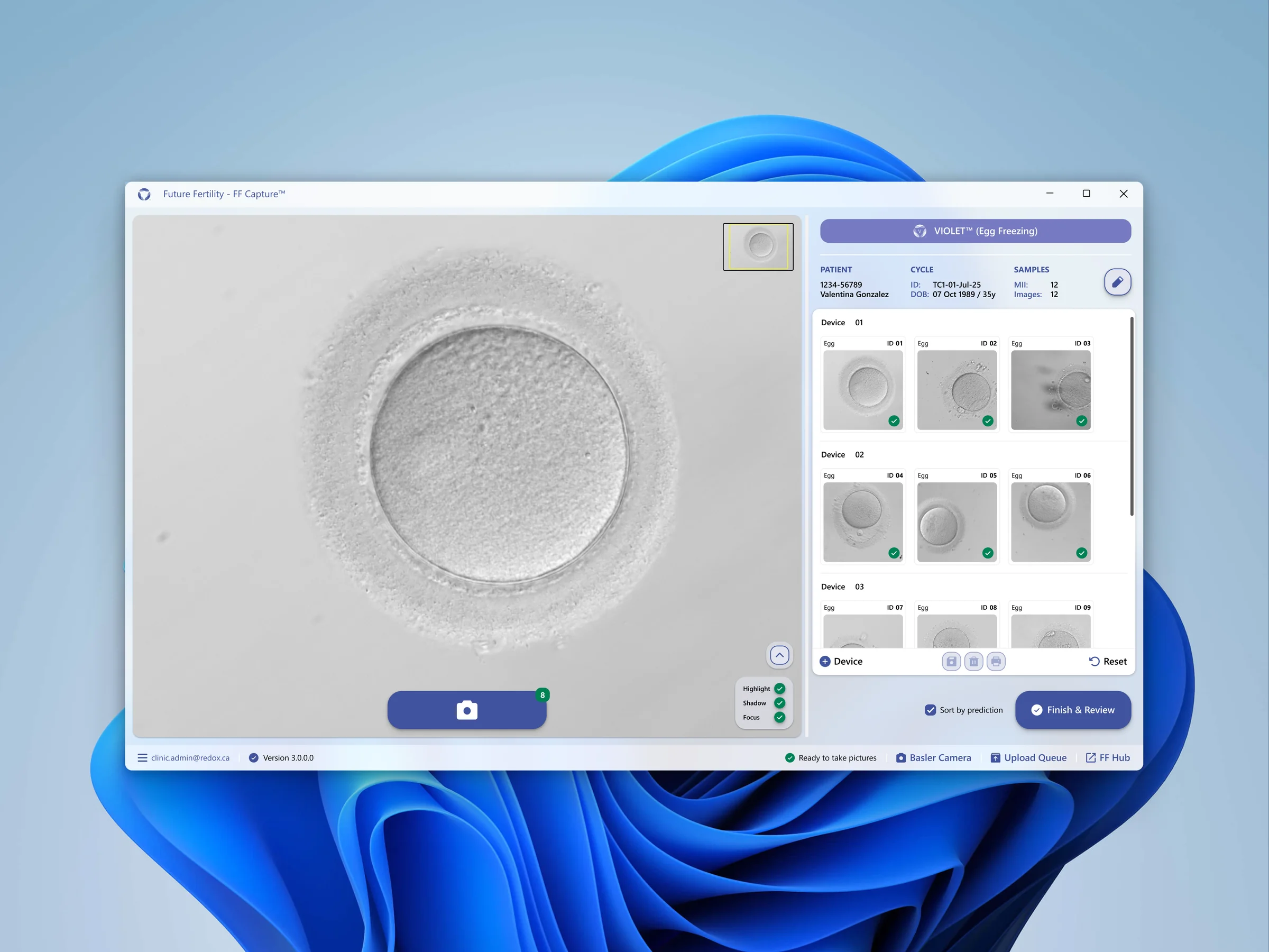 FF Capture — VIOLET egg-freezing theme, light mode